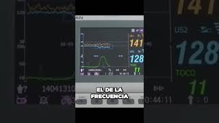 Cómo ESCUCHAR frecuencia Cardiaca Fetal Monitor fetal F6 [upl. by Ecirtnahs262]