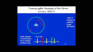 CCTA Training Lecture 1B Temporal and Spatial Resolution in Cardiac CT [upl. by Alis]