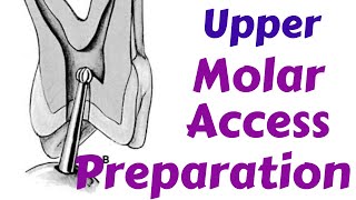 Upper Maxillary Molars  Endodontic Access cavity Preparation Endodontic Lecture amp Tutorial [upl. by Aenyl176]