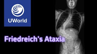 Friedreich Ataxia amp Cardiomyopathy  USMLE STEP 1 USMLE UWorld Question MBBS [upl. by Doty]