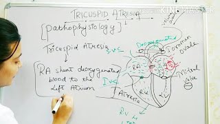 TRICUSPID ATRESIA CONGENITAL HEART DISEASE EASY EXPLANATION  PEDIATRIC NURSING [upl. by Etom954]