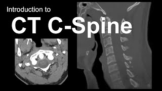 Introduction to CT Cspine Approach and Essentials [upl. by Kletter]