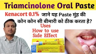 Kenacort 01  Kenacort gel how to use  Triamcinolone oromucosal paste bp 01 ww in hindi [upl. by Maudie]