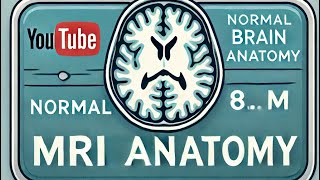 quotUnderstanding Normal Brain MRI Anatomy  Explained in Simple Termsquot [upl. by Rizas]