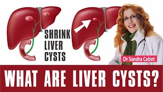 LIVER CYST  Symptoms  Natural Treatment  Diet  Supplements  Is a livercyst Dangerous [upl. by Esinrahc]