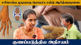 சரி செய்ய முடியாத ரொமட்டாய்டு ஆர்த்ரைடிஸை குணப்படுத்திய அதிசயம்  Sugalaya [upl. by Erdried]