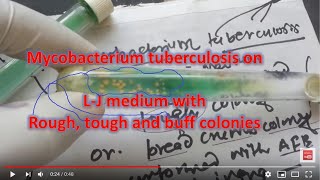 Mycobacterium tuberculosis grown in L J medium [upl. by Rudyard]