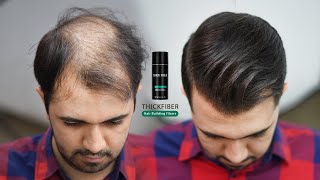 Hair Style For Very Thin amp Balding Hair by using Hair Fibers 2022 [upl. by Lareine]