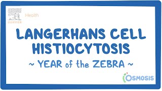 Langerhans cell histiocytosis Year of the Zebra [upl. by Liana]