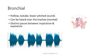 Bronchial breath sounds [upl. by Nada]