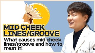 【HUSHU】Mid face linesgroove What causes mid cheek linesgroove and how to treat it [upl. by Nylyaj]