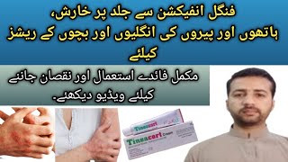 Tineacort Cream  Miconazole amp Hydrocortisone  Uses Benifit Side Effects In Urdu [upl. by Kcarb]