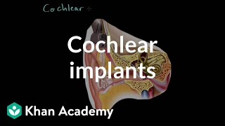 Cochlear implants  Processing the Environment  MCAT  Khan Academy [upl. by Hartman]