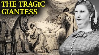 Was She History’s Most Tragic Giantess  Anna Haining Bates [upl. by Anitaf653]