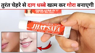 Jhai Safa Cream Review  jhai safa cream kaise use kare [upl. by Lura671]