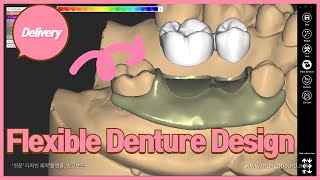 Exocad Flexible Denture Design  치과기공사 엑소캐드 플렉시블 덴쳐만들기 [upl. by Corabel]