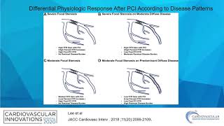 Physiology post PCI The new gold standardHakeemCoronary on Demand [upl. by Ingelbert]