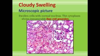 Cell Response to Injury 2nd pathology lecture [upl. by Godart]