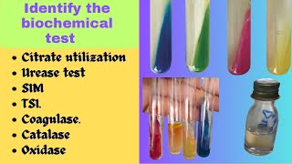 Biochemical Test  Bacterial Identification Technique Microbiology Practical Exam bacteriology [upl. by Drain]