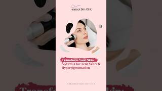 Erase Acne Scars amp Hyperpigmentation with Slyfirm X at Agelock Skin Clinic Chandigarh [upl. by Ecirtra907]