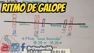 Que es el ritmo de galope en la auscultacion facil y sencillo [upl. by Stanway]