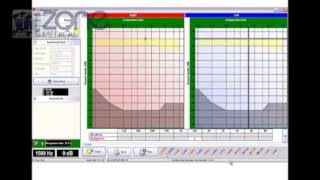 Zone Medical Audiometer PC Based [upl. by Adnoluy]