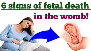 6 Signs of fetal death in the womb and How to prevent it  Stillbirth signs and prevention [upl. by Ayres]