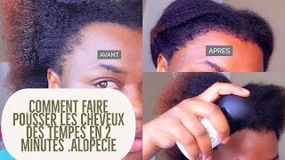 Comment faire pousser les cheveux des tempes en 2 minutes [upl. by Ermine]