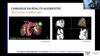 06 Chirurgie en réalité augmenté  tour dhorizon [upl. by Anella]