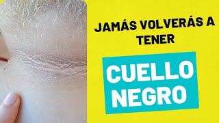 Si tienes el cuello negro no dejes de ver este video Cuiddo [upl. by Eiloj]