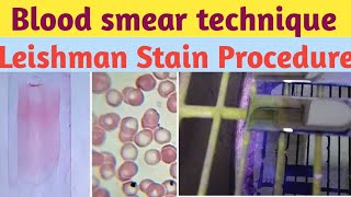 PERIPHERAL BLOOD SMEAR  HAEMATOLOGY LAB  LEISHMAN STAIN PHYSIOLOGY PRACTICALS [upl. by Eelta]