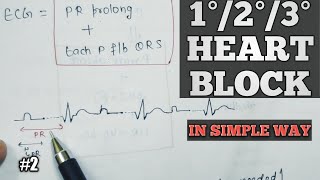 FirstsecondThird degree heart block  Cardiac arrhythmia in hindi  Av block  2 [upl. by Now]