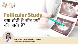 Follicular Study क्या होती है और क्यों की जाती है Follicular Study in Hindi  Dr Rhythm Gupta [upl. by Noslrac]