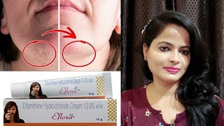 How To Use Eflora Cream  Eflora Cream Review Eflornithine Cream PraGri style [upl. by Htnnek555]