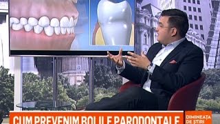 Laserul in tratarea bolii parodontale [upl. by Tergram]