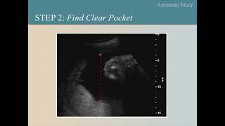 Ultrasound Training Course 10 part 1 [upl. by Garvey]