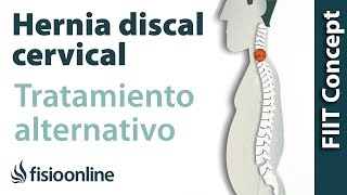 Hernia discal cervical izquierda por disfunción de vesícula biliar Plantas medicinales [upl. by Arne]