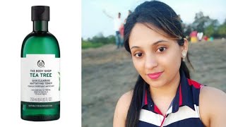 I tried body shop tea tree toner for a month  This is what happened  suitable for blemished skin [upl. by Dulcle]