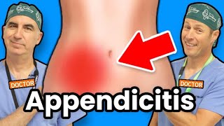 Appendicitis  How Do I Know If I Have Appendicitis [upl. by Eeral568]