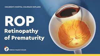 Retinopathy of Prematurity Diagnosis and Treatment [upl. by Oric306]