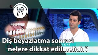 Diş beyazlatma sonrası nelere dikkat edilmelidir [upl. by Keldah]