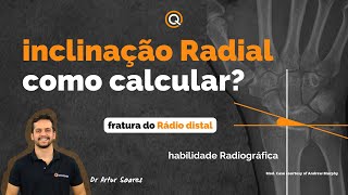 Inclinação Radial na Fratura do Radio Distal Habilidades no TEOT por Dr Artur Soares [upl. by Lupien332]