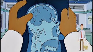 Trans Nasal Approaches to the Brain in TV and Film  The Simpsons amp Total Recall [upl. by Bernardina]