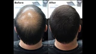 THICK FIBER  Hair Building Fibers is a hair loss concealer fiber Cover up Bald patches [upl. by Yk164]