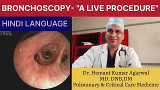 BRONCHOSCOPY quotA Live Procedurequot HINDI Basic A to Z about FOB Anatomy of Bronchi Dr Hemant K A [upl. by Vories]