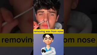 Nose hair removal failure  Doctor explains how to remove stucked wax in nose idoctor [upl. by Hsur]