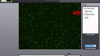 Analysis of Mononuclear Cells MNC from Bone Marrow [upl. by Dolly]