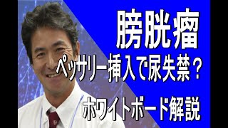 【女性泌尿器科】ペッサリー挿入で骨盤臓器脱の患者さんが尿失禁になる理由（ホワイドボード解説） [upl. by Lilith770]