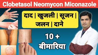 दाद खुजली को ठीक करने की क्रीम । Clobetasol Neomycin and Miconazole cream [upl. by Madanhoj]