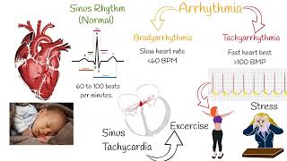 Tachycardia  Most Common causes and Symptoms [upl. by Winny893]